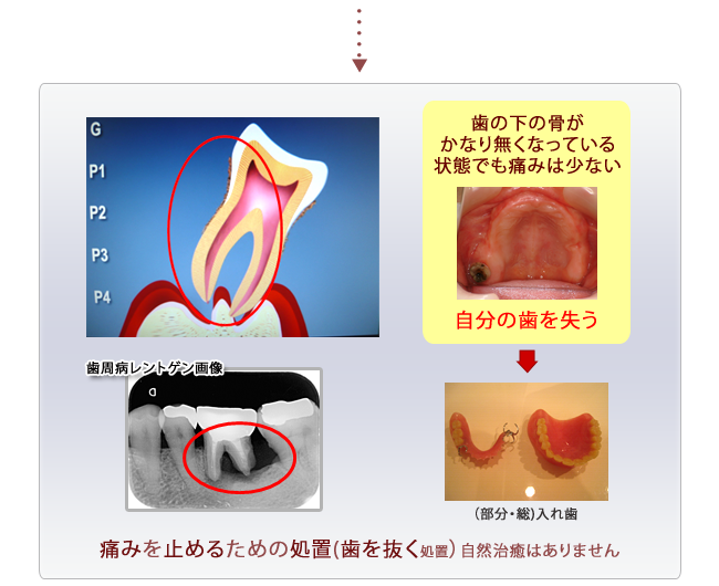歯科の最先端の治療法