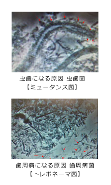 細菌